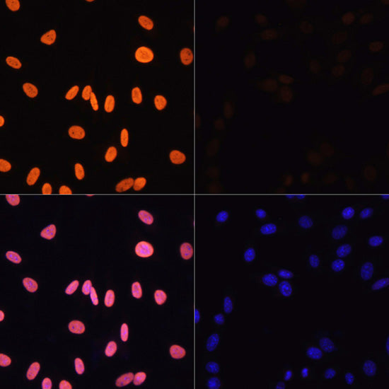 Acetyl-Histone H3-K4 Rabbit pAb