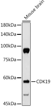 CDK19 Rabbit pAb