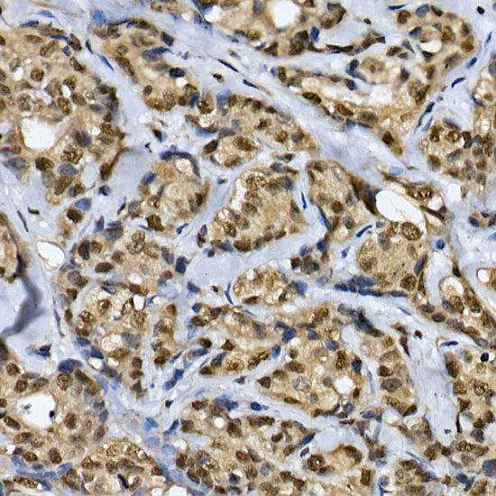 CDK19 Rabbit pAb