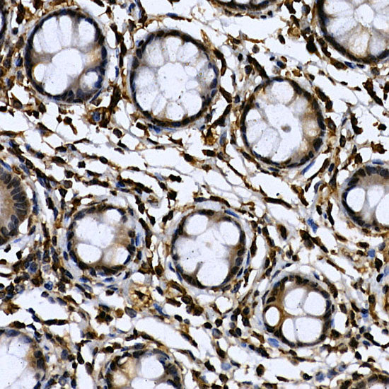 CDK19 Rabbit pAb