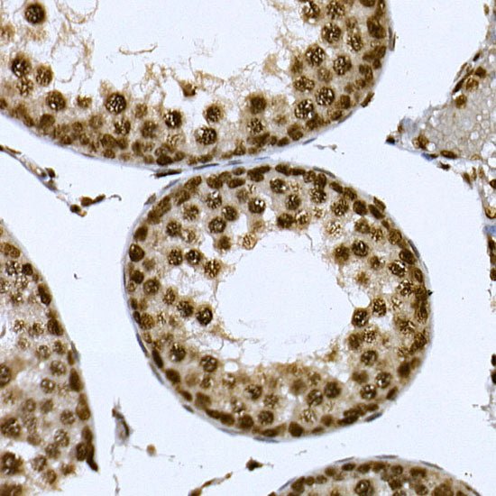 CDK19 Rabbit pAb