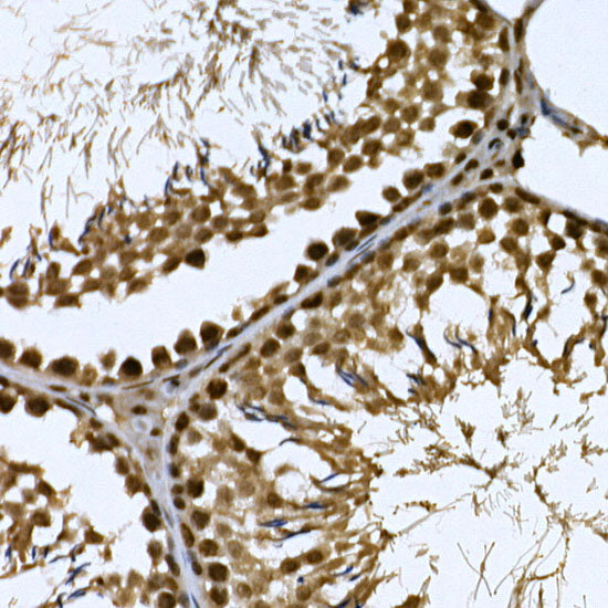 CDK19 Rabbit pAb