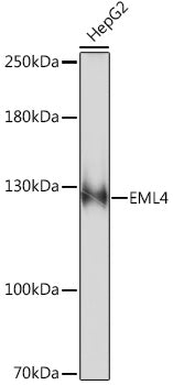 EML4 Rabbit pAb