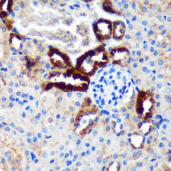 EML4 Rabbit pAb