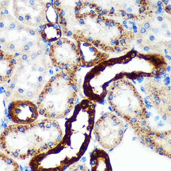 EML4 Rabbit pAb