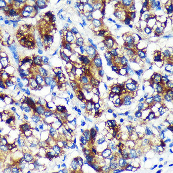 EML4 Rabbit pAb