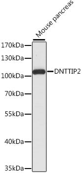 DNTTIP2 Rabbit pAb