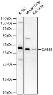 CAB39 Rabbit pAb