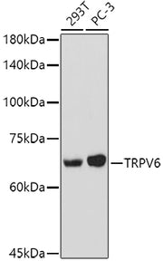 TRPV6 Rabbit pAb