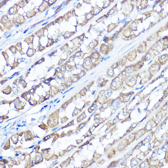 TRPV6 Rabbit pAb