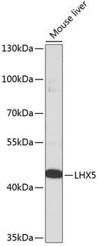 LHX5 Rabbit pAb