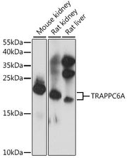 TRAPPC6A Rabbit pAb