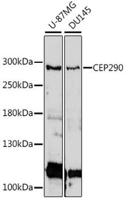 CEP290 Rabbit pAb