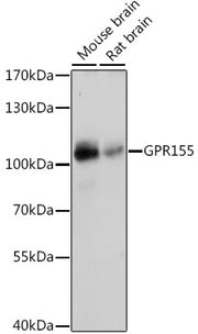GPR155 Rabbit pAb