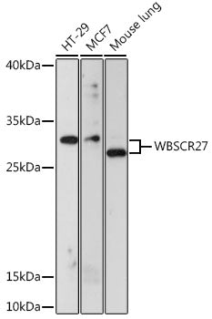 WBSCR27 Rabbit pAb