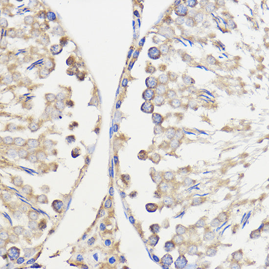 WBSCR27 Rabbit pAb