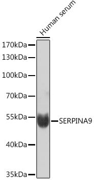 SERPINA9 Rabbit pAb