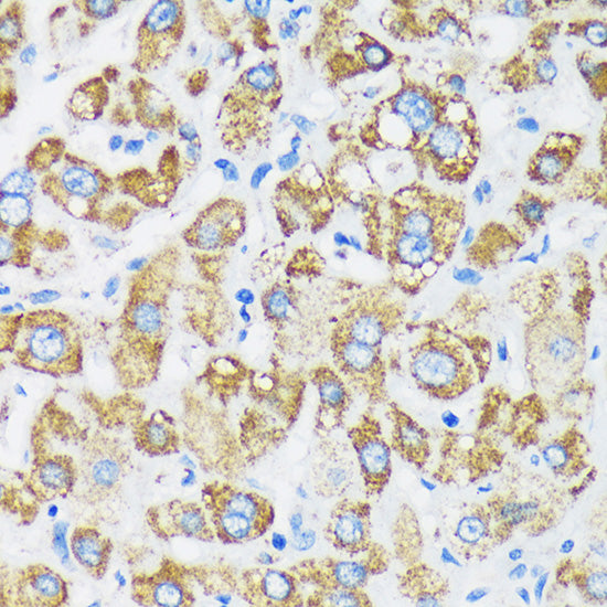 GTPBP8 Rabbit pAb