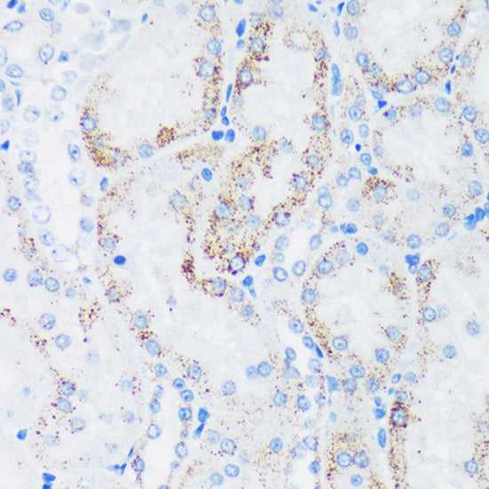 GTPBP8 Rabbit pAb