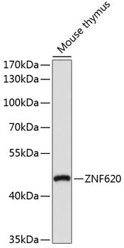 ZNF620 Rabbit pAb
