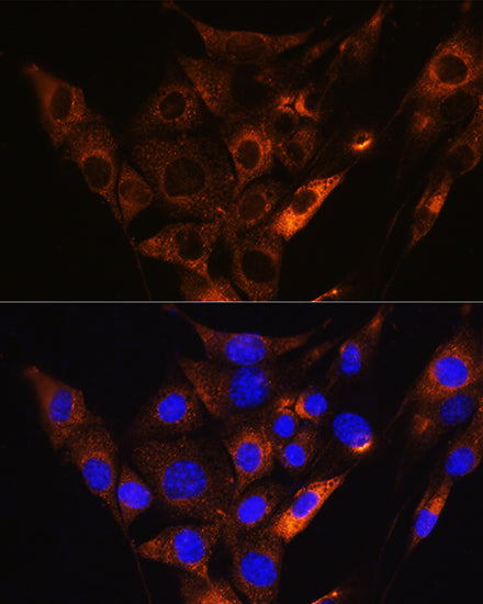 HCN1 Rabbit pAb