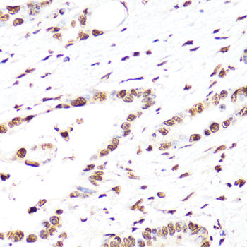 TriMethyl-Histone H3-K27 Mouse mAb