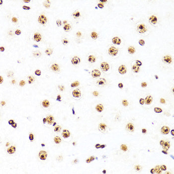TriMethyl-Histone H3-K27 Mouse mAb