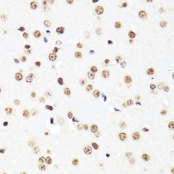 TriMethyl-Histone H3-K27 Mouse mAb