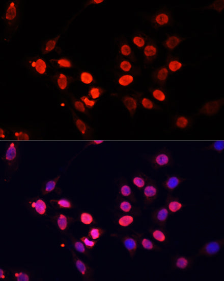 TriMethyl-Histone H3-K27 Mouse mAb