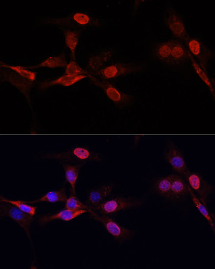 TriMethyl-Histone H3-K27 Mouse mAb