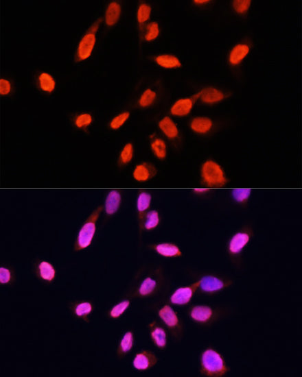 TriMethyl-Histone H3-K27 Mouse mAb