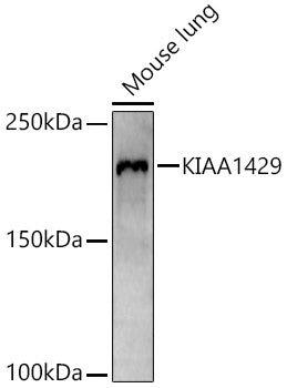VIRMA/KIAA1429 Rabbit pAb