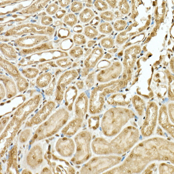 VIRMA/KIAA1429 Rabbit pAb