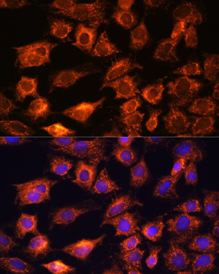 PTCD1 Rabbit pAb