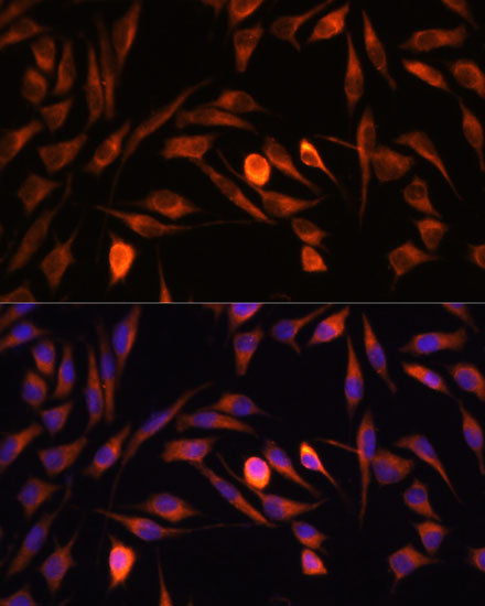 PTCD1 Rabbit pAb