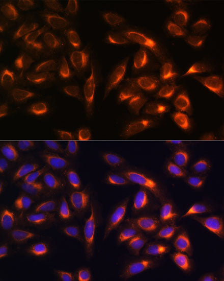 PTCD1 Rabbit pAb