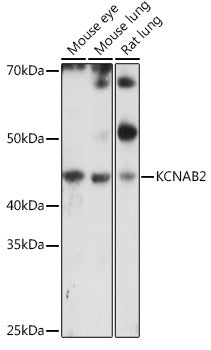 KCNAB2 Rabbit pAb