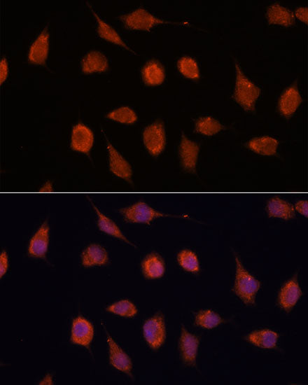 KCNAB2 Rabbit pAb