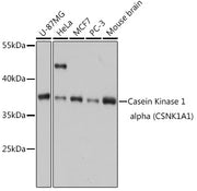 Casein Kinase 1 alpha (CSNK1A1) Rabbit pAb
