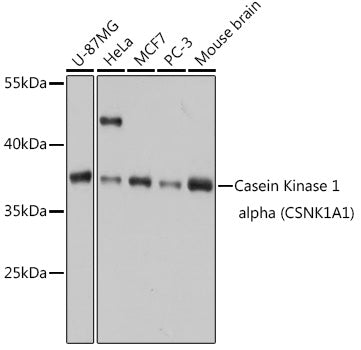 Casein Kinase 1 alpha (CSNK1A1) Rabbit pAb