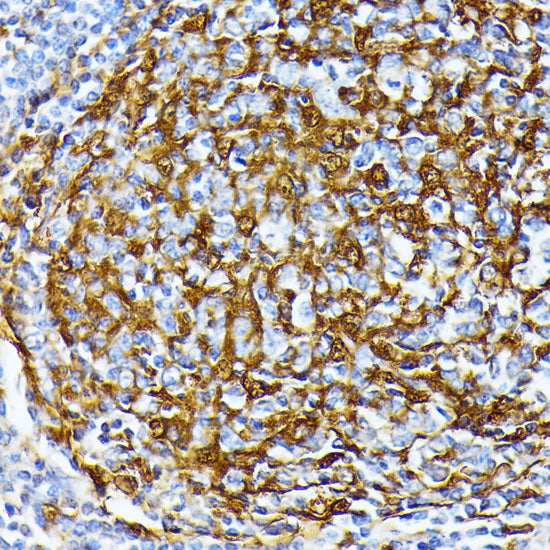 Casein Kinase 1 alpha (CSNK1A1) Rabbit pAb