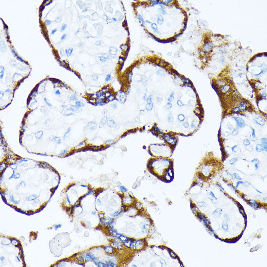 Casein Kinase 1 alpha (CSNK1A1) Rabbit pAb
