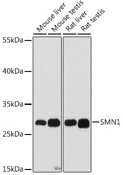 SMN1 Rabbit pAb