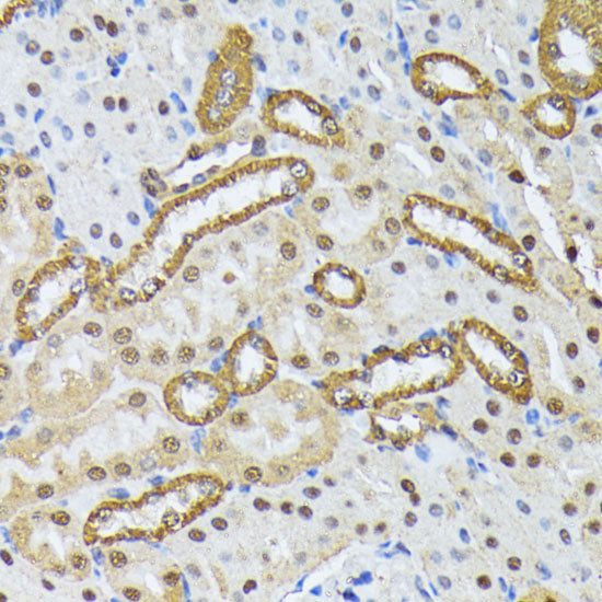 SMN1 Rabbit pAb