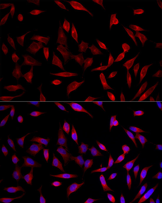 ACSL1 Rabbit pAb