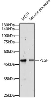 PLGF Rabbit pAb