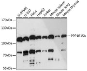 PPP1R15A Rabbit pAb
