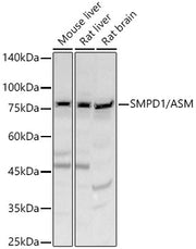 SMPD1 / ASM Rabbit pAb