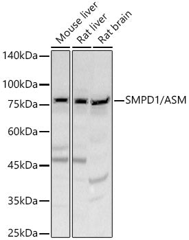 SMPD1 / ASM Rabbit pAb