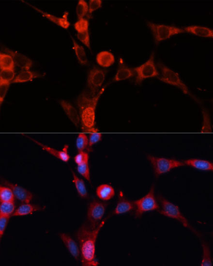 SMPD1 / ASM Rabbit pAb